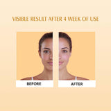 Aravi Organic SPF 50+ Daily Sunscreen Stick -13 gm image 4