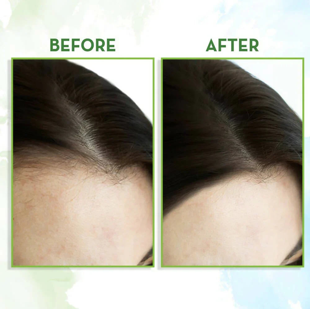 Mamaearth Rosemary Hair Growth Oil with Rosemary & Methi Dana -150 ml image 4