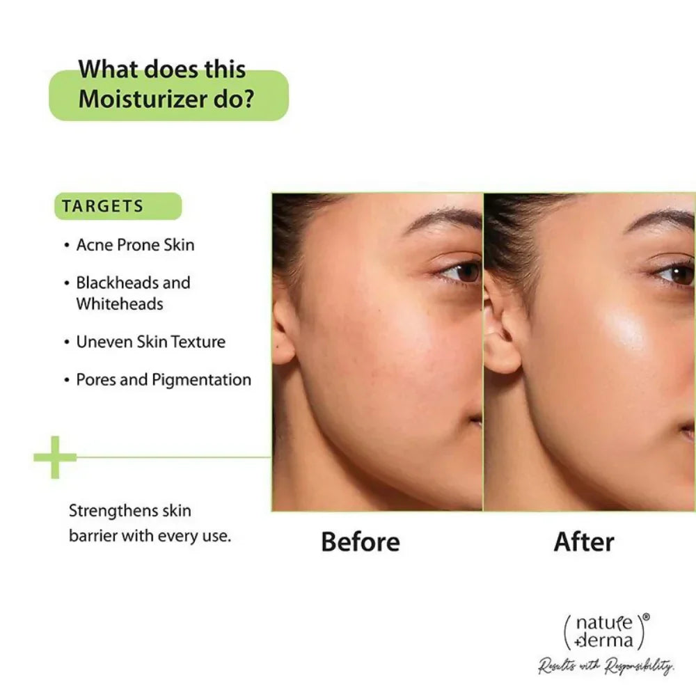 Nature Derma 1% Natural Biome-Boost Moisturizer -15 ml image 3