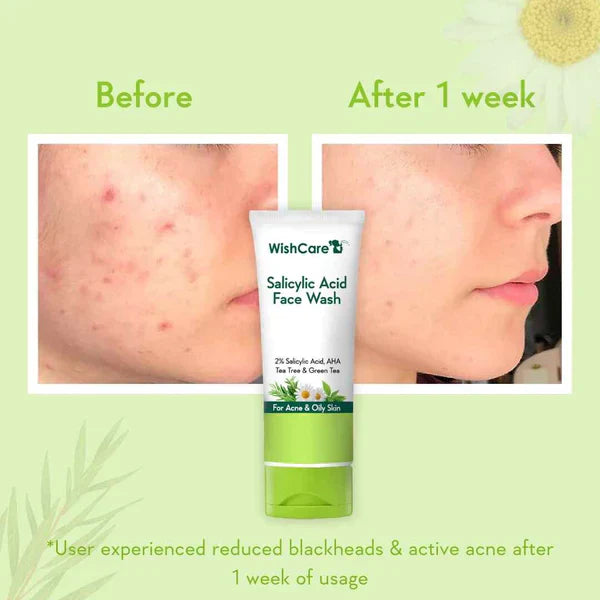 2% Salicylic Acid Face Wash - 100ml image 4