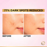 L'Oreal Paris Glycolic Bright 8% [Melasyl + Niacinamide] Face Serum For Brightening Dark Spots image 7