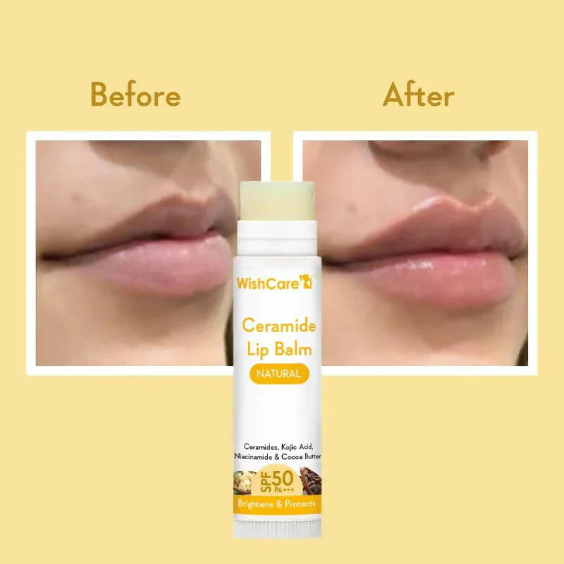 Wishcare Ceramide Lip Balm - SPF 50 | (5g) image 2